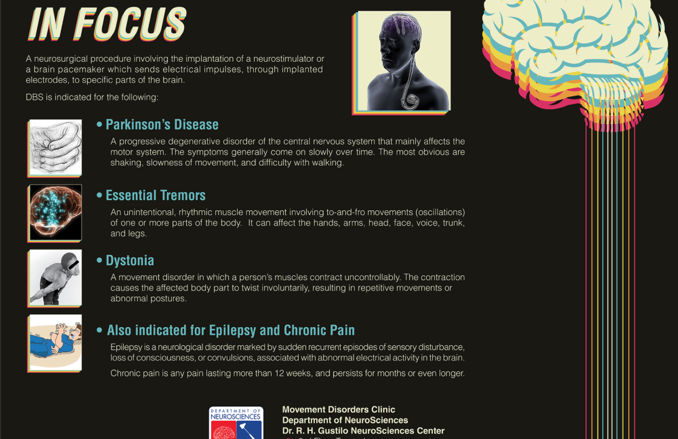 Deep Brain Stimulation in Focus (2017)