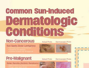 Common Sun-induced Dermatologic Conditions
