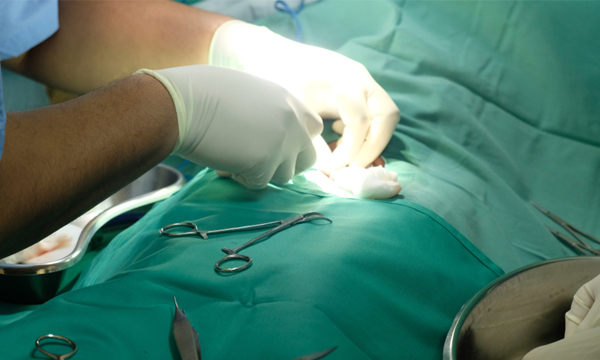 circumcision procedure