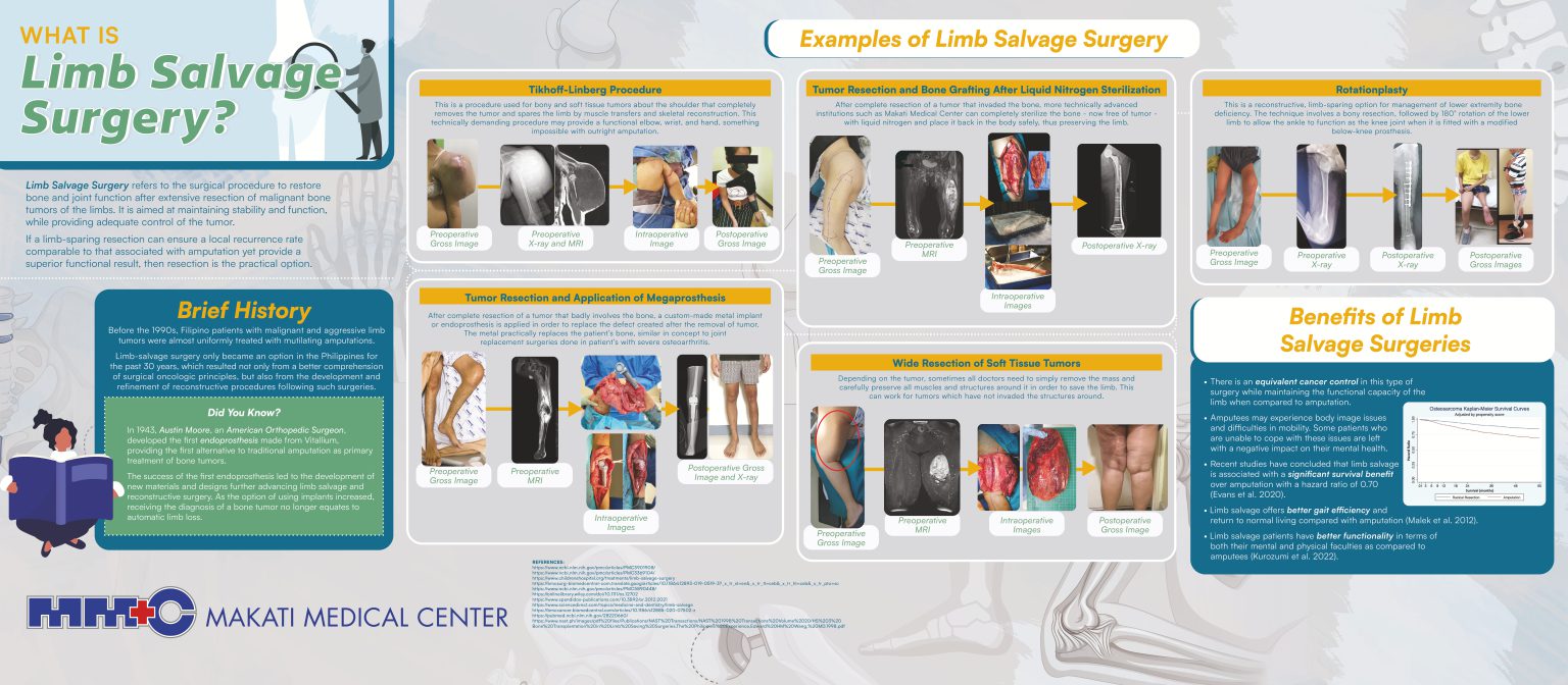 Limb Salvage Surgery Exhibits Makati Medical Center